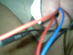 Hard estim with urethra-electrodes