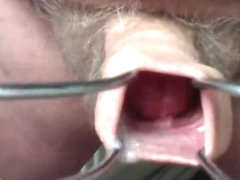 Foreskin extravaganza - 4 of 4