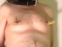 Dr Peeemeee and Fabio: penis treatment