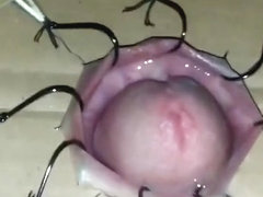Extreme cock torture with fishhooks  part 1