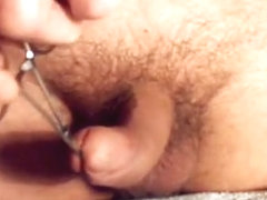 meatotomy step three