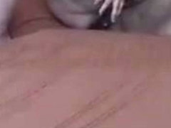 Please dont mind my dark skin patches due to my pcos.