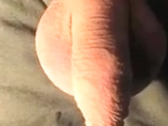 two hooks in the foreskin, adhesive paper