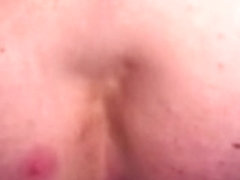 Niet kijken, pukkel op m'n bil...