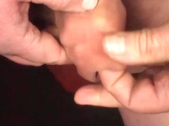 Foreskin with 17 batteries