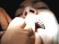 Braces Cleaning, dental fetish
