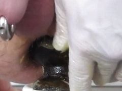 big buttplug extreme anal nearly fisting