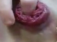 Kinkylolaxxx - Camgirl prolapse