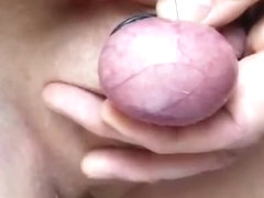 Akkupunkturnadel durch Hodensack